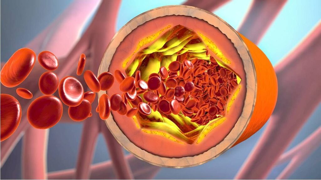 colesterol en el cuerpo humano